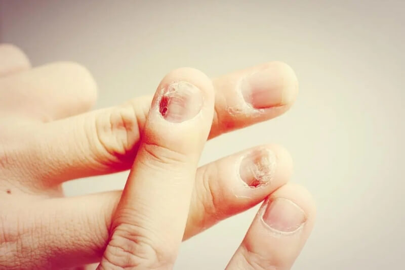 Tránh để móng tay tiếp xúc với nước và hóa chất